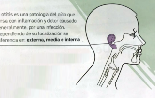 otitis